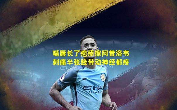 嘴唇长了疱疹擦阿昔洛韦刺痛半张脸带动神经都疼